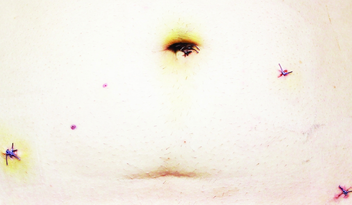 Zapraszamy na otwarcie nowej wystawy na ekspozytorze!